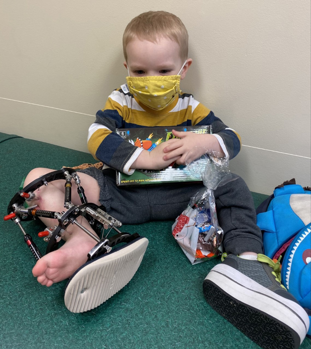 A pediatric patient with an external fixator on his leg holding toys he received as a gift