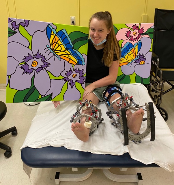 Hannah holding her canvas paintings with external fixators on her legs