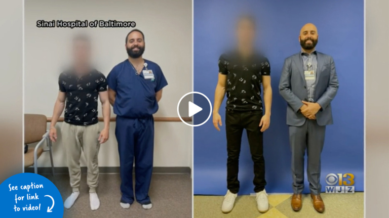 Dr. Michael Assayag taller than a patient before surgery in one picture next to another picture of the same patient taller than Dr. Assayag after surgery