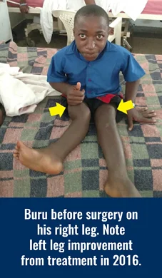 Buru's legs before surgery on his right leg in 2018