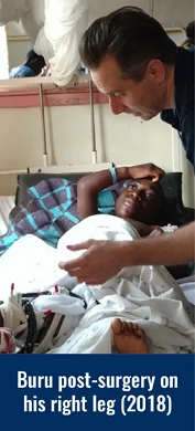 Buru post-surgery on his right leg in 2018