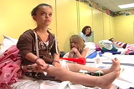 Dwarfism patient with an external fixator on her leg talking about her treatment at the International Center for Limb Lengthening during physical therapy