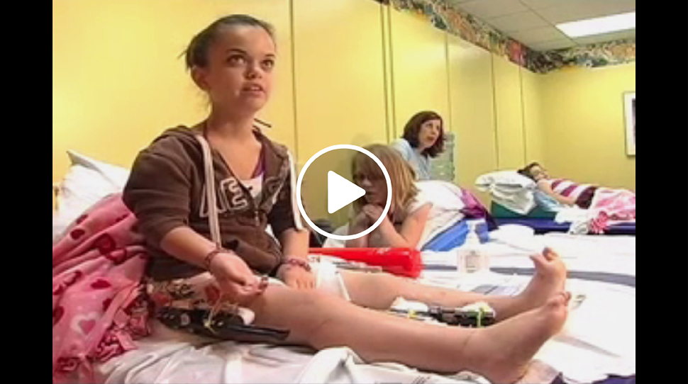 Dwarfism patient with an external fixator on her leg talking about her treatment at the International Center for Limb Lengthening during physical therapy