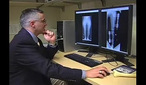 Dr. Shawn Standard examining x-rays of a Dwarfism patient at the International Center for Limb Lengthening