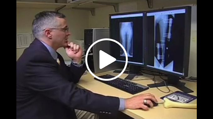 Dr. Shawn Standard examining x-rays of a Dwarfism patient at the International Center for Limb Lengthening