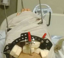 Jacob's ankle during treatment