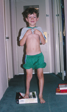 Christopher as a young boy showing leg length difference