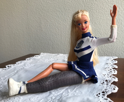 Katia's Barbie doll with a leg in a cast like hers