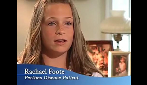Rachael, a patient with Perthes disease, discusses her treatment at the International Center for Limb Lengthening
