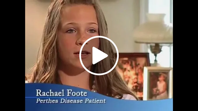 Rachael, a patient with Perthes disease, discusses her treatment at the International Center for Limb Lengthening