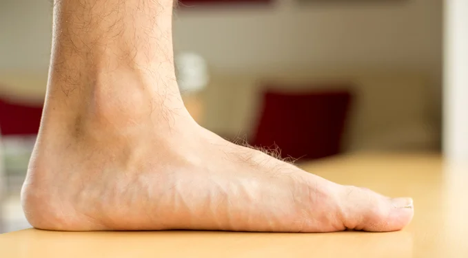 Closeup of man's flatfoot