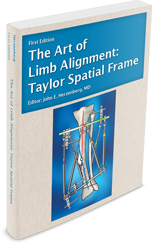 Book cover for The Art of Limb Alignment: Taylor Spatial Frame, edited by Dr. John E. Herzenberg