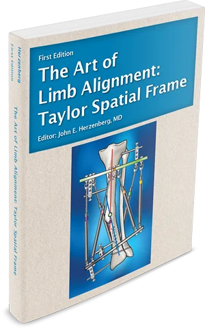 Book cover for The Art of Limb Alignment: Taylor Spatial Frame, edited by Dr. John E. Herzenberg