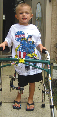 Jeffrey at 3 with an external fixator and walker