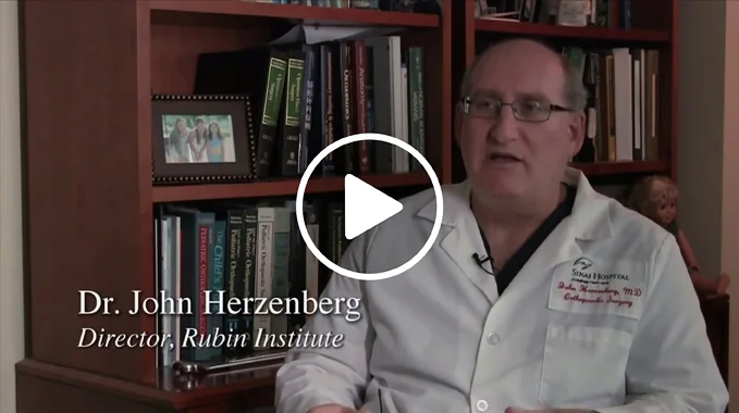 Dr. John Herzenberg Explains Fibular Hemimelia and Congenital Femoral Deficiency Video