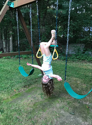 Charlotte hanging upside down from her knees from a bar on a playground despite a 7 cm limb length difference