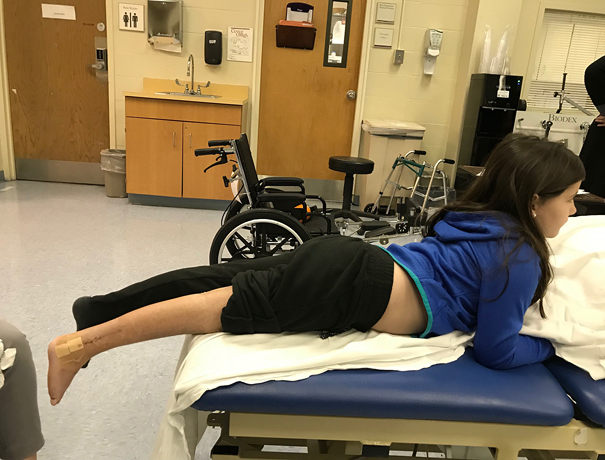 Gracie lying on her stomach on a physical therapy table at the Rubin Institute for Advanced Orthopedics Rehabilitation Department after her leg cast was removed