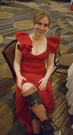 Lisa in a formal red dress wearing her brace