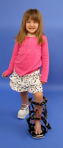 Emma as a young girl wearing an external fixator