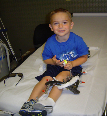 Matt on a hospital bed with an external fixator on one leg