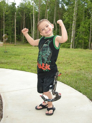 Matt wearing an external fixator on one leg showing his arm muscles when he was 4