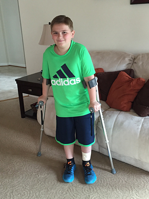 Matt at age 11 with crutches after lengthening was completed