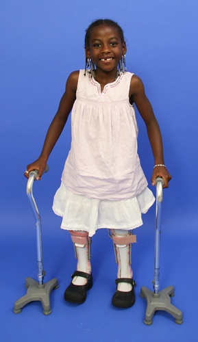 Melissa standing with leg braces and canes