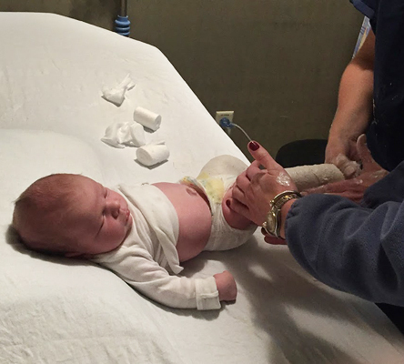 Cannon as an infant getting casts put on
