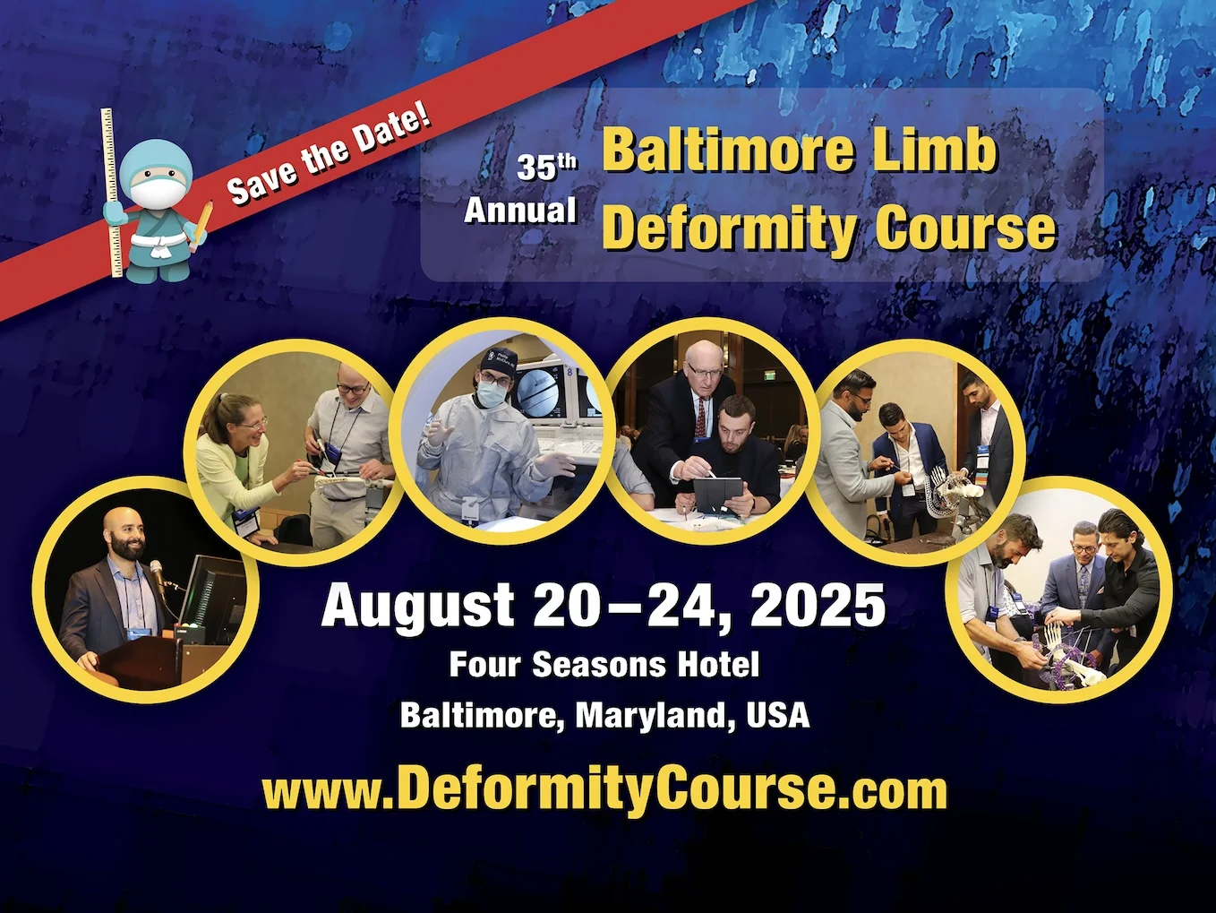 Baltimore Limb Deformity Course International Center for Limb Lengthening Baltimore Limb Deformity Course International Center for Limb Lengthening