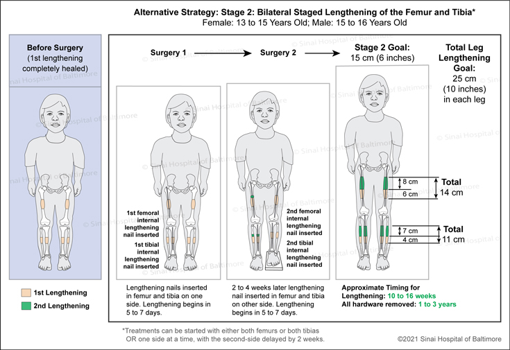 Achondroplasia: Surgical Treatment Plan for Lengthening, Alternative Strategy 1, 2nd Stage: Bilateral staged lengthening of the femur and tibia at around 13 to 15 years old for females and 15 to 16 years old for males to include femur and tibia lengthening nails in one side of the lower limb. Nails are inserted in the other side 2 to 4 weeks later.