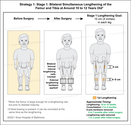 Dwarfism International Center For Limb Lengthening