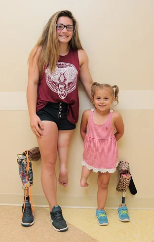 Brooklynn and Danica, two patients who have undergone the rotationplasty procedure, standing next to their prostheses.