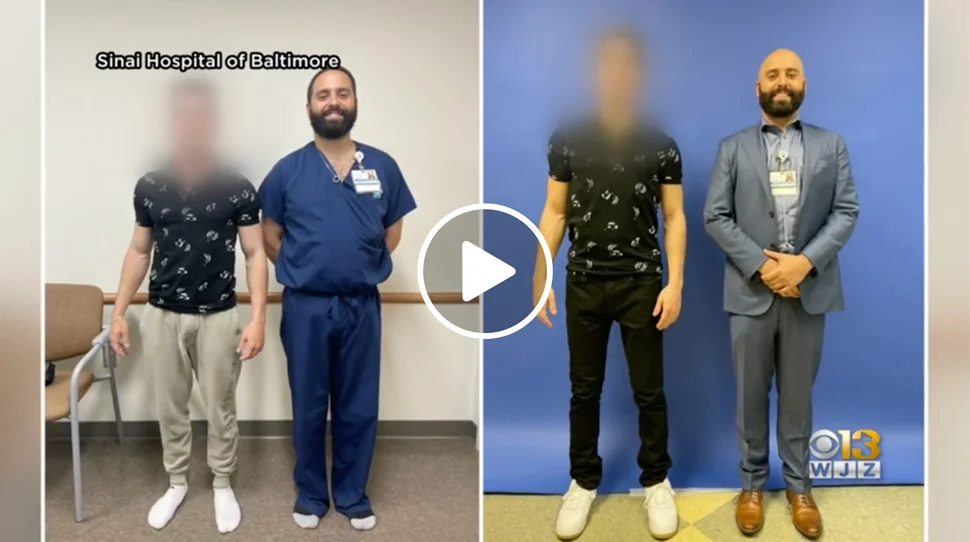Dr. Michael Assayag taller than a patient before surgery in one picture next to another picture of the same patient taller than Dr. Assayag after surgery