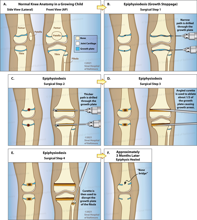 Thigh meaning in malay