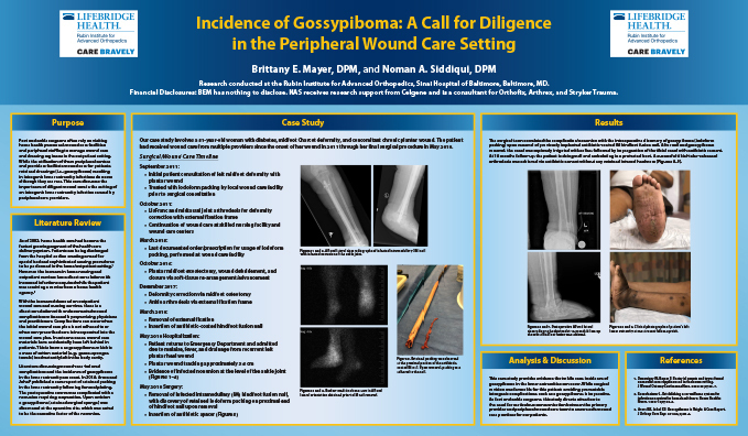 Research poster presented at the Annual Meeting of the American College of Foot and Ankle Surgeons in San Antonio, Texas in February 2020 - Incidence of Gossypiboma - A Call for Diligence in the Peripheral Wound Care Setting