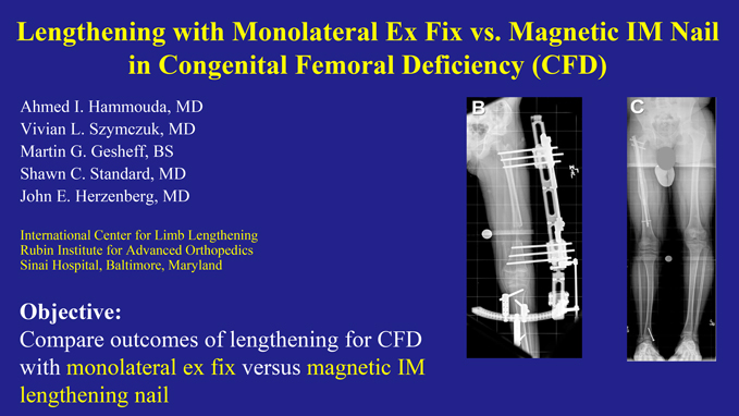 Research poster presented at the Annual Meeting of the American Orthopaedic Association in Charlotte, North Carolina in June 2017