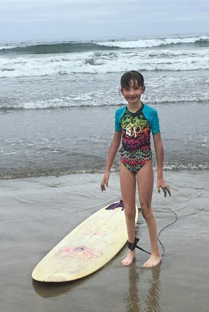 Luisa surfing after treatment for bilateral clubfoot