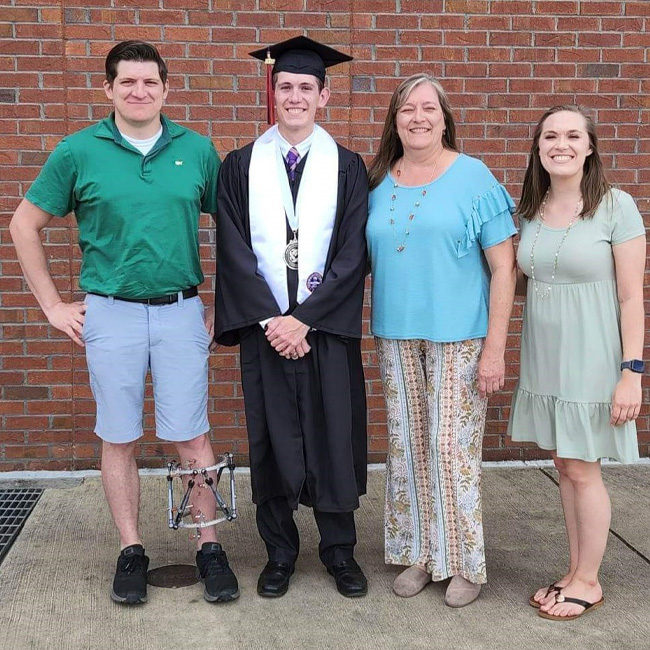 Andrew wearing an external fixator standing with family at his brother's graduation