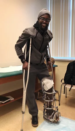 Ebou wearing an external fixator and using crutches in clinic