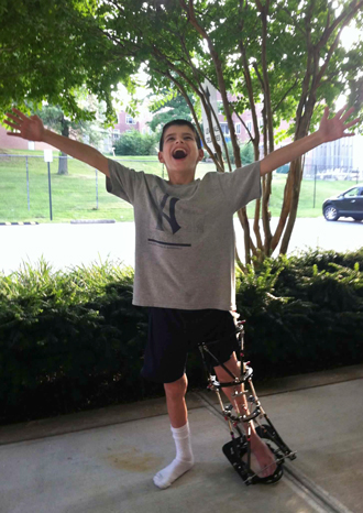 Jack with his arms in the air shouting outside happily with an external fixator on his leg