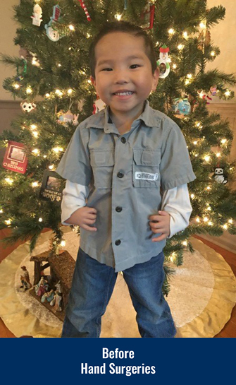 James smiling in front of a Christmas tree before his hand surgeries