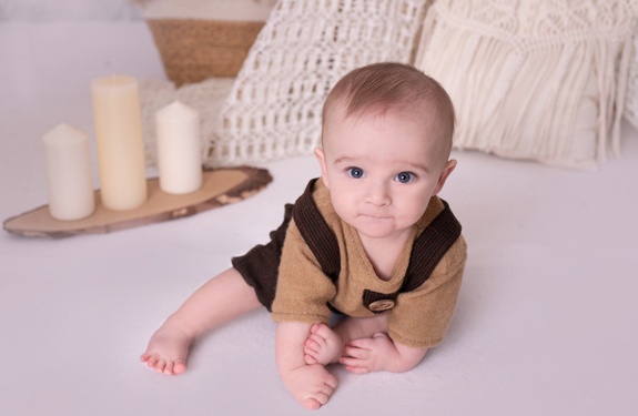 Kacper as a baby with club hands