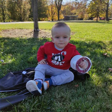 Kacper outside after his first ulnarization surgery for club hand, with an external fixator on his arm