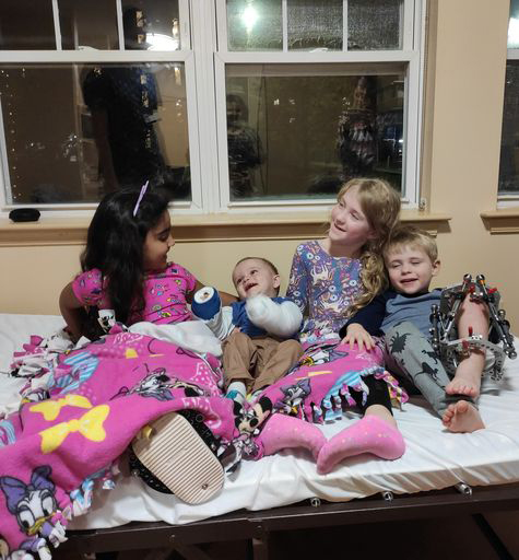 Kacper with other children at the Hackerman-Patz House after his second surgery for club hand