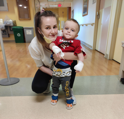 Kacper with his mom after cast removal for club hand