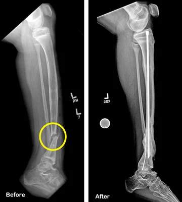 Zuri's before X-ray showing the break in his bone and his after X-ray showing the healed bone