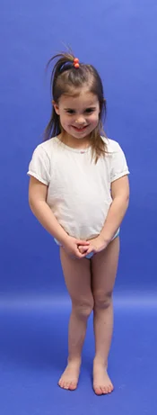 Cassidy as a very young girl in a clinic picture showing her leg length discrepancy