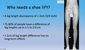 Text on a slide from a video discussing who needs a shoe lift